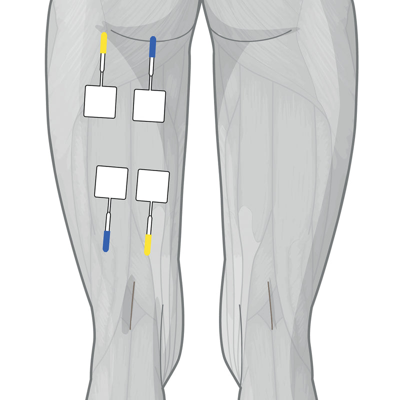 Load image into Gallery viewer, Genesy 3000