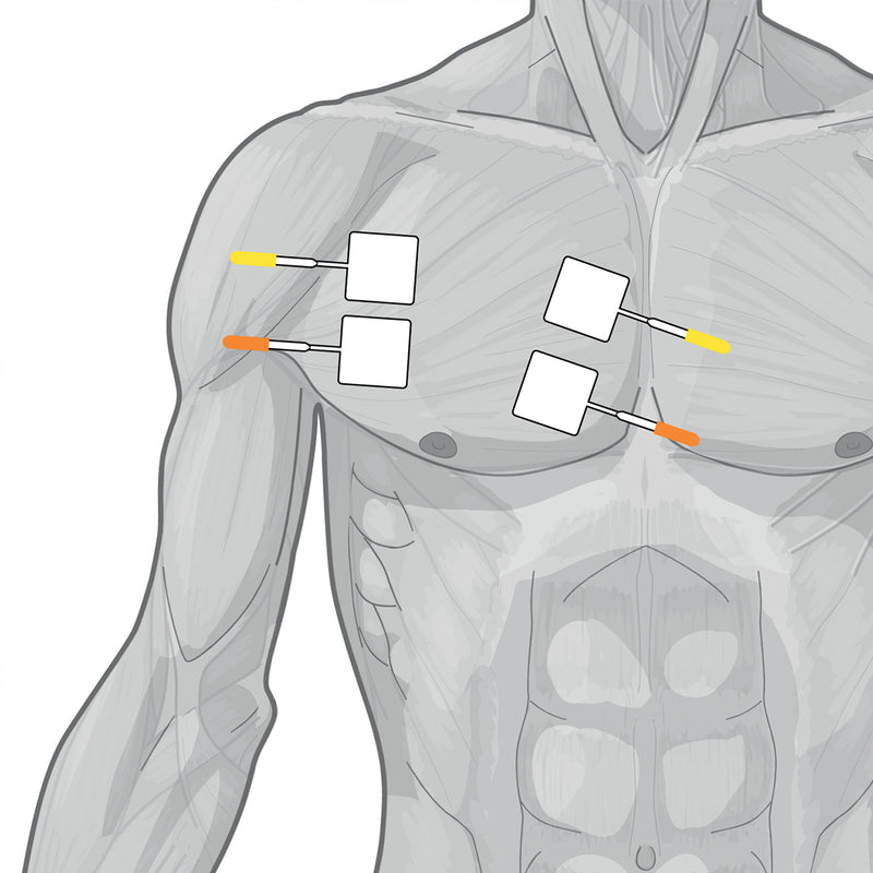 Load image into Gallery viewer, Genesy 300 Pro