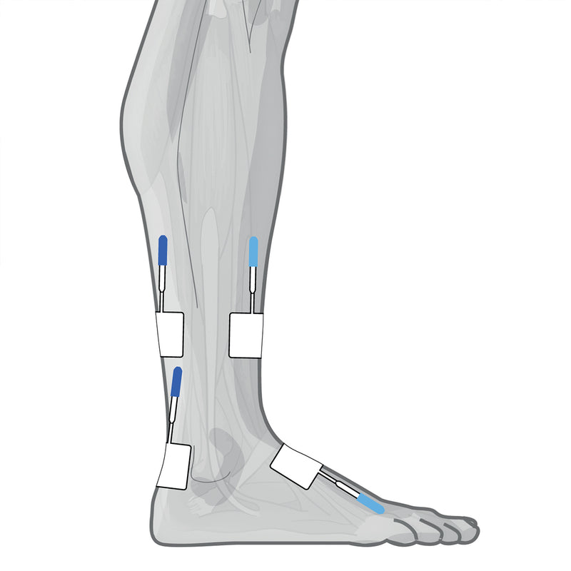 Load image into Gallery viewer, Genesy 300 Pro