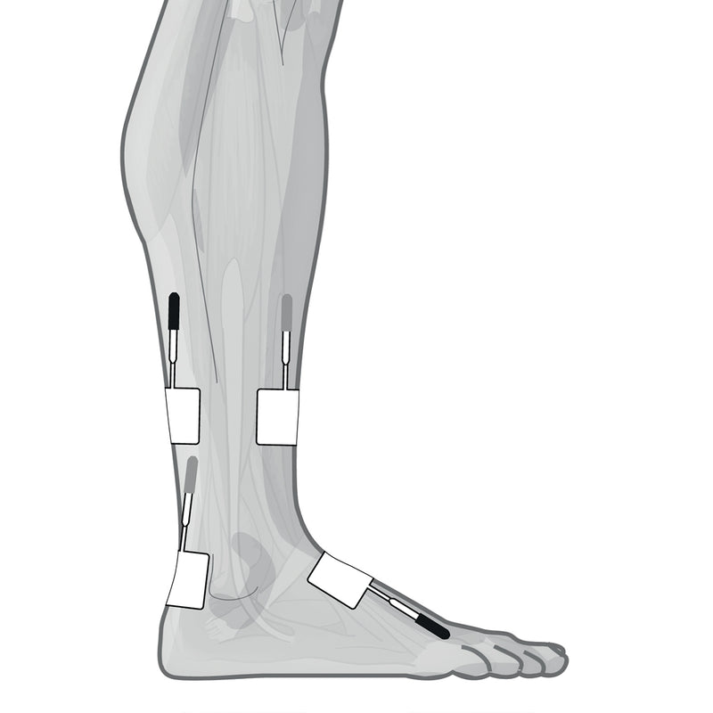 Load image into Gallery viewer, Genesy 600