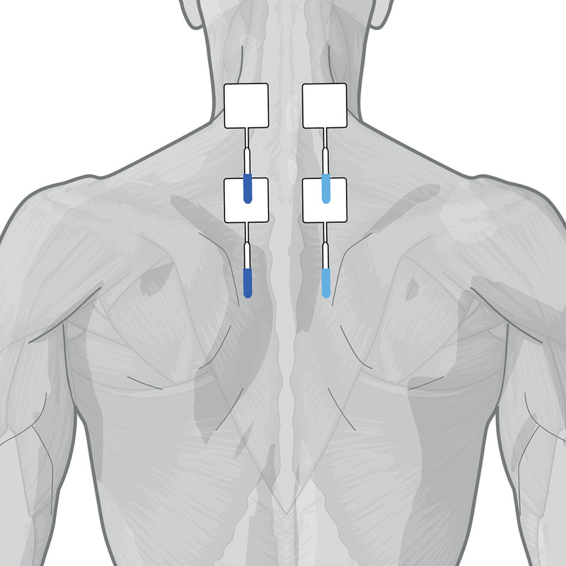 Load image into Gallery viewer, Genesy 1500