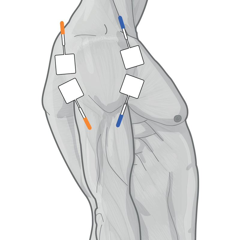 Load image into Gallery viewer, Genesy 1500