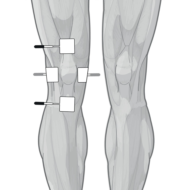 Load image into Gallery viewer, Genesy 1500